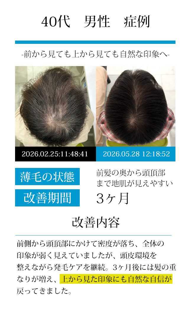 男性30代