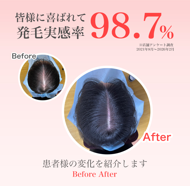 発毛実績一覧