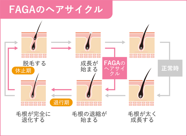 ヘアサイクルとFAGAの関係図