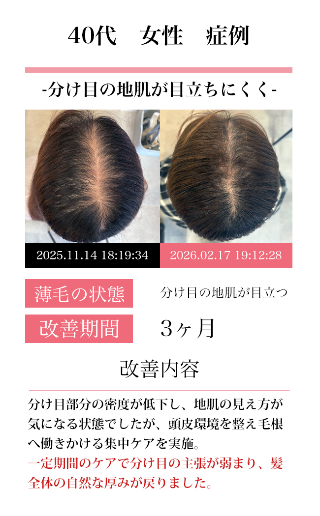 女性40代