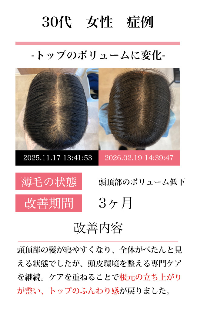 女性30代