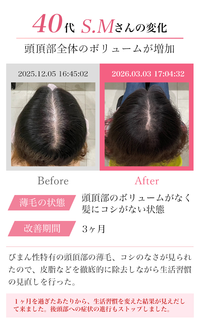 女性30代