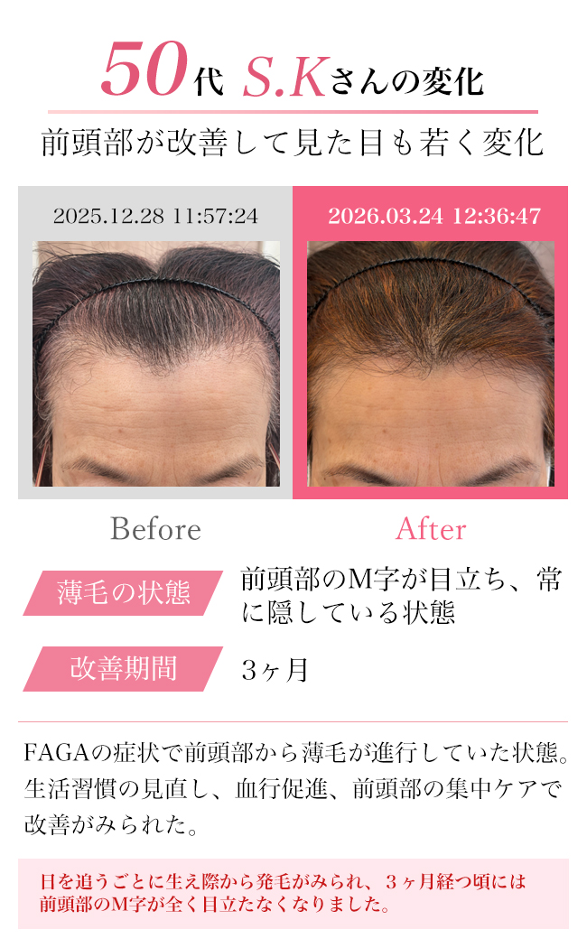 女性30代
