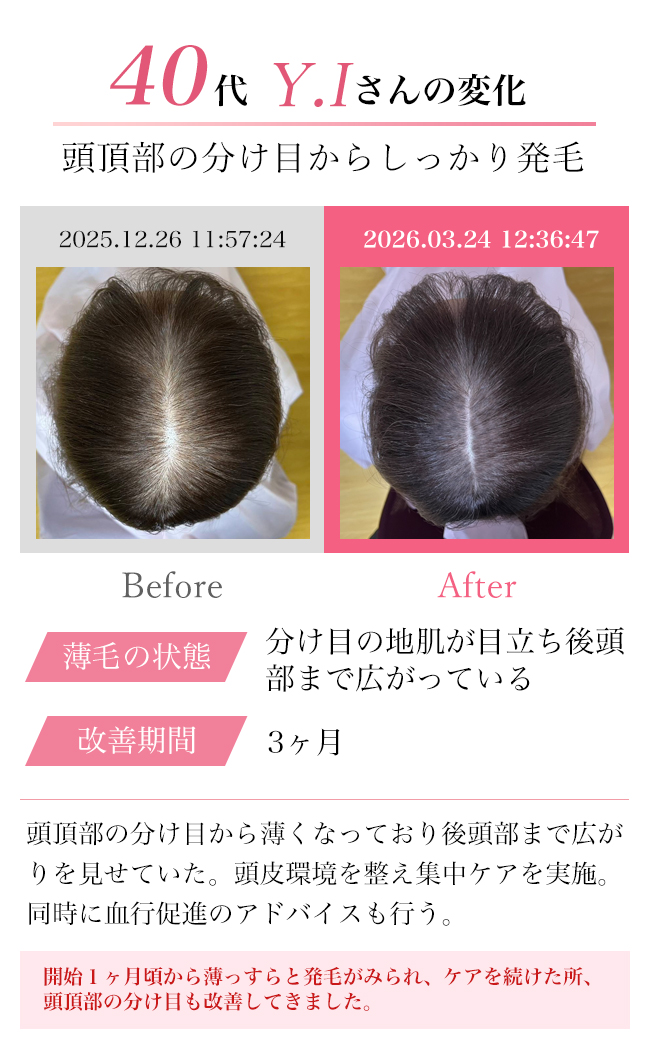 女性30代