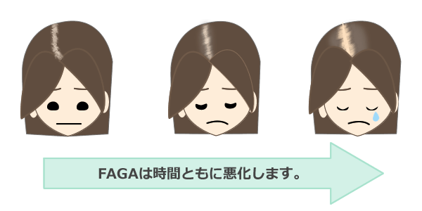 FAGA(男女型脱毛症）の対策