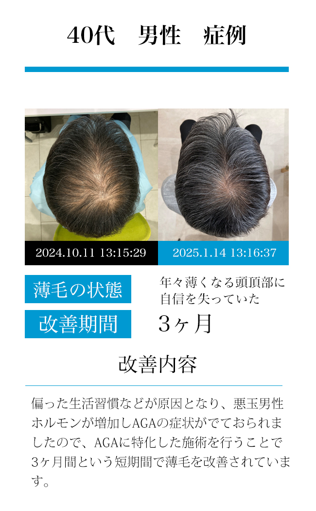 男性40代