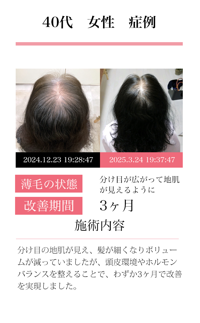 女性30代