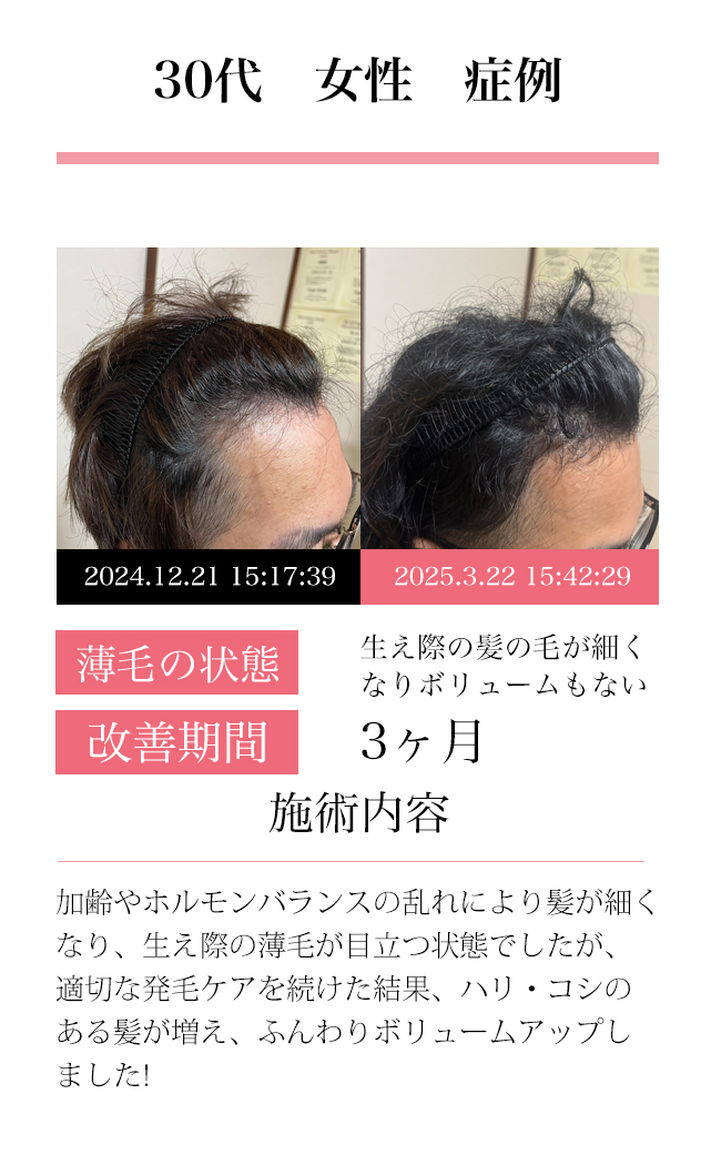 女性30代