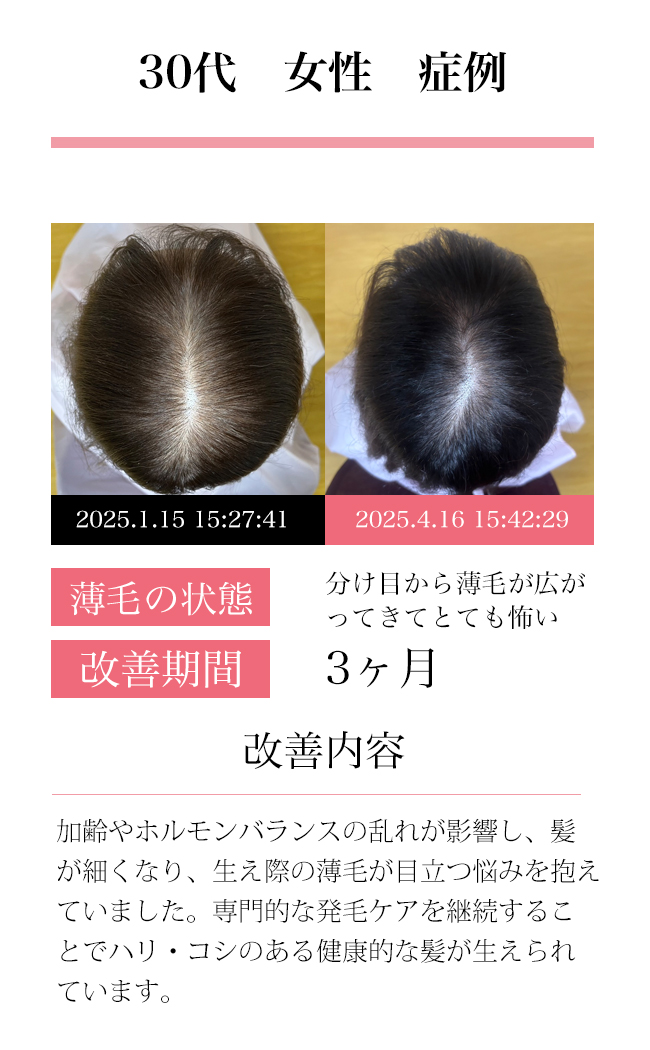 女性30代