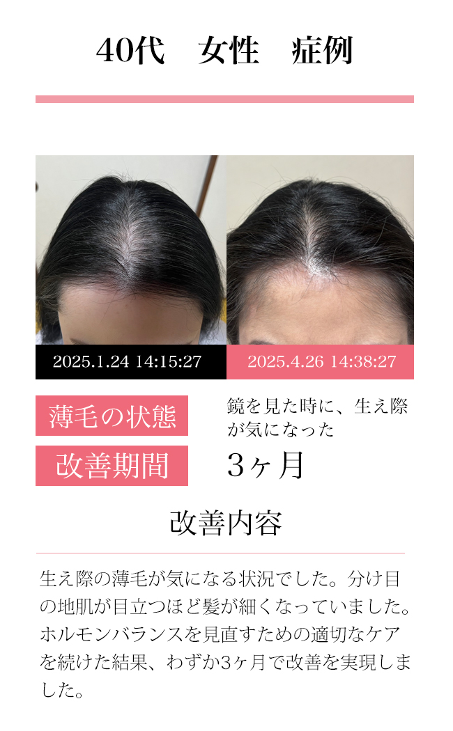 女性40代