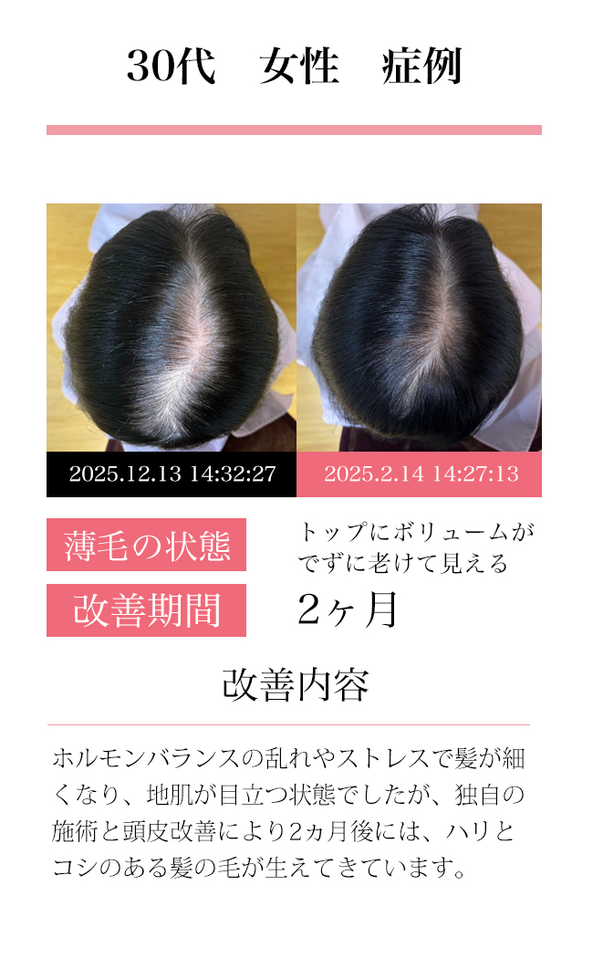 女性30代
