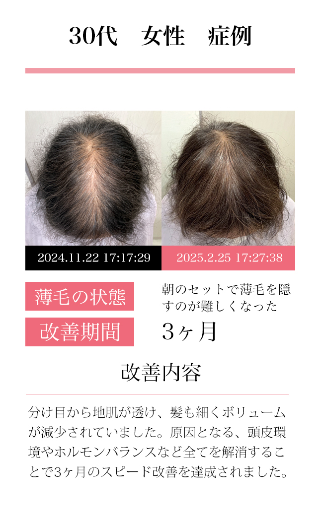 女性30代