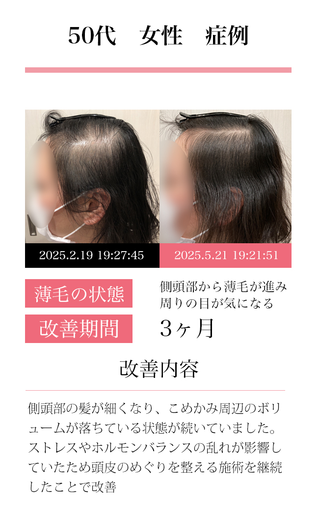 女性30代
