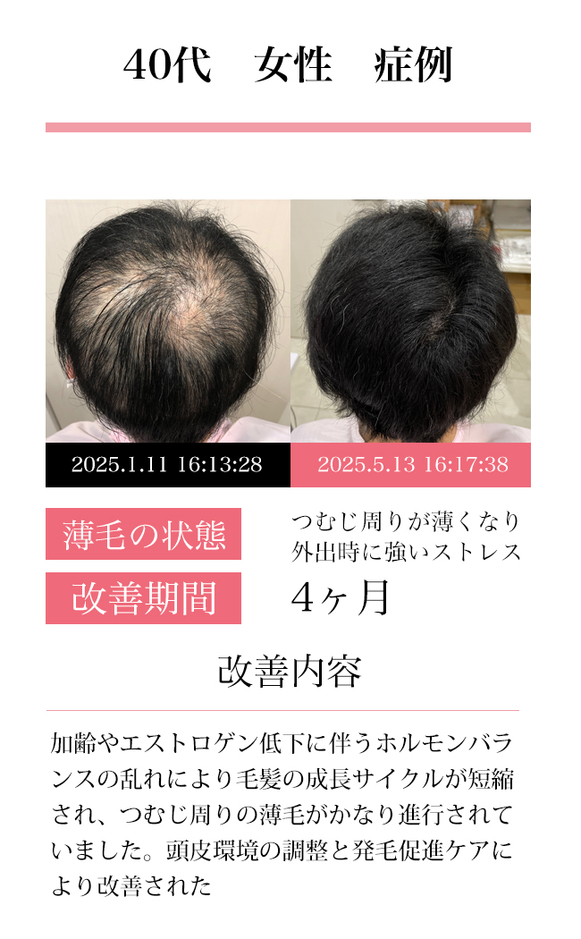 女性30代