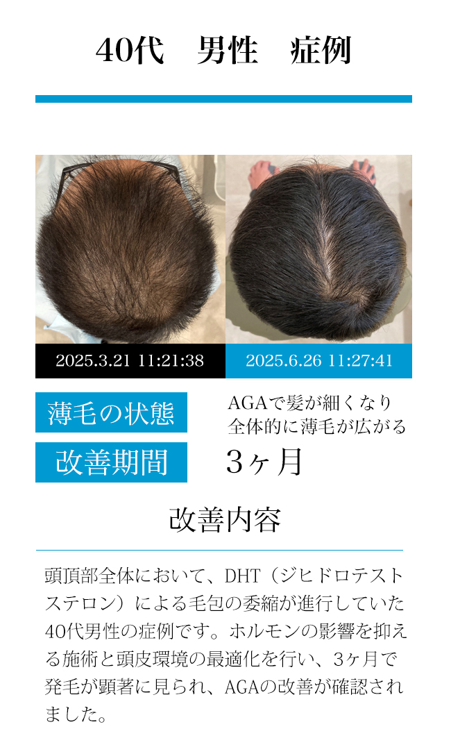 男性30代