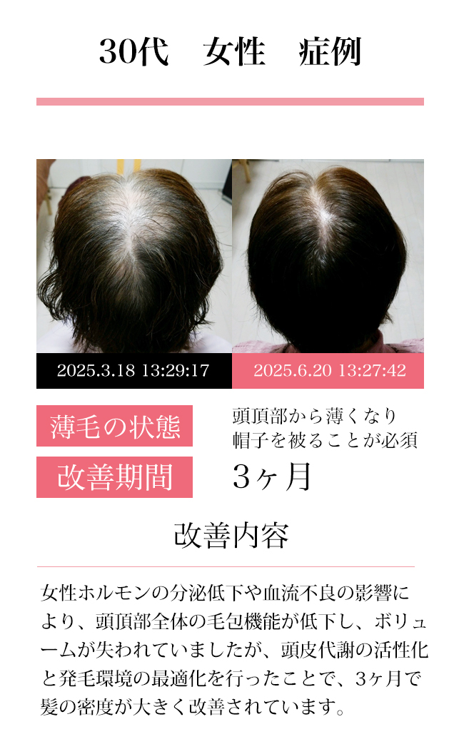 女性30代