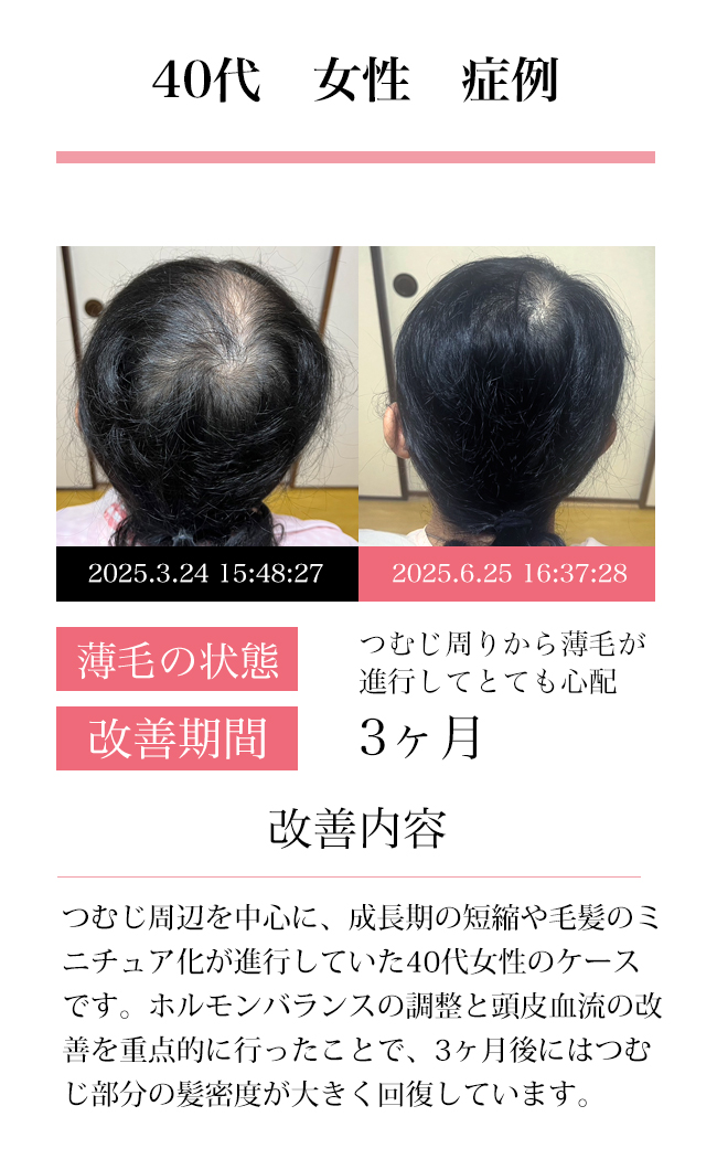 女性30代