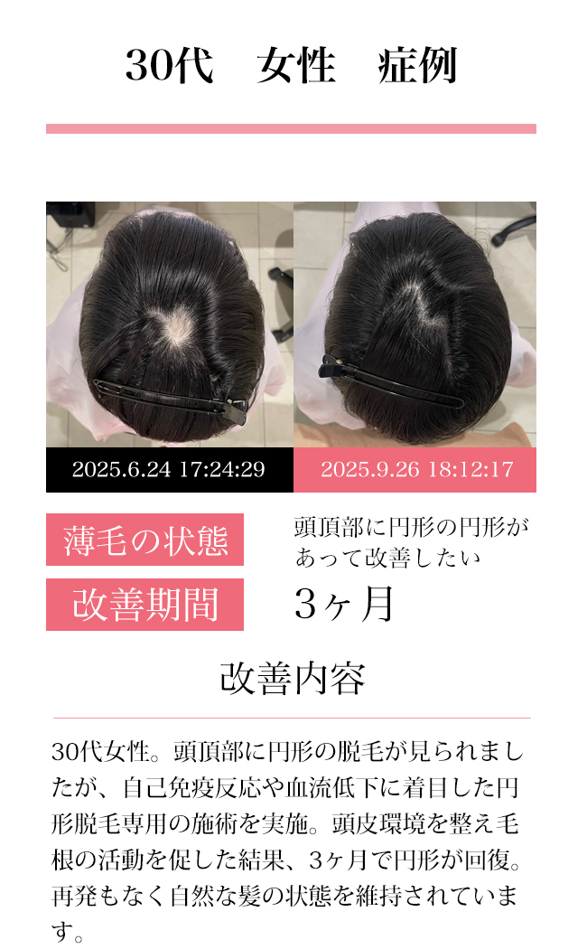 女性30代
